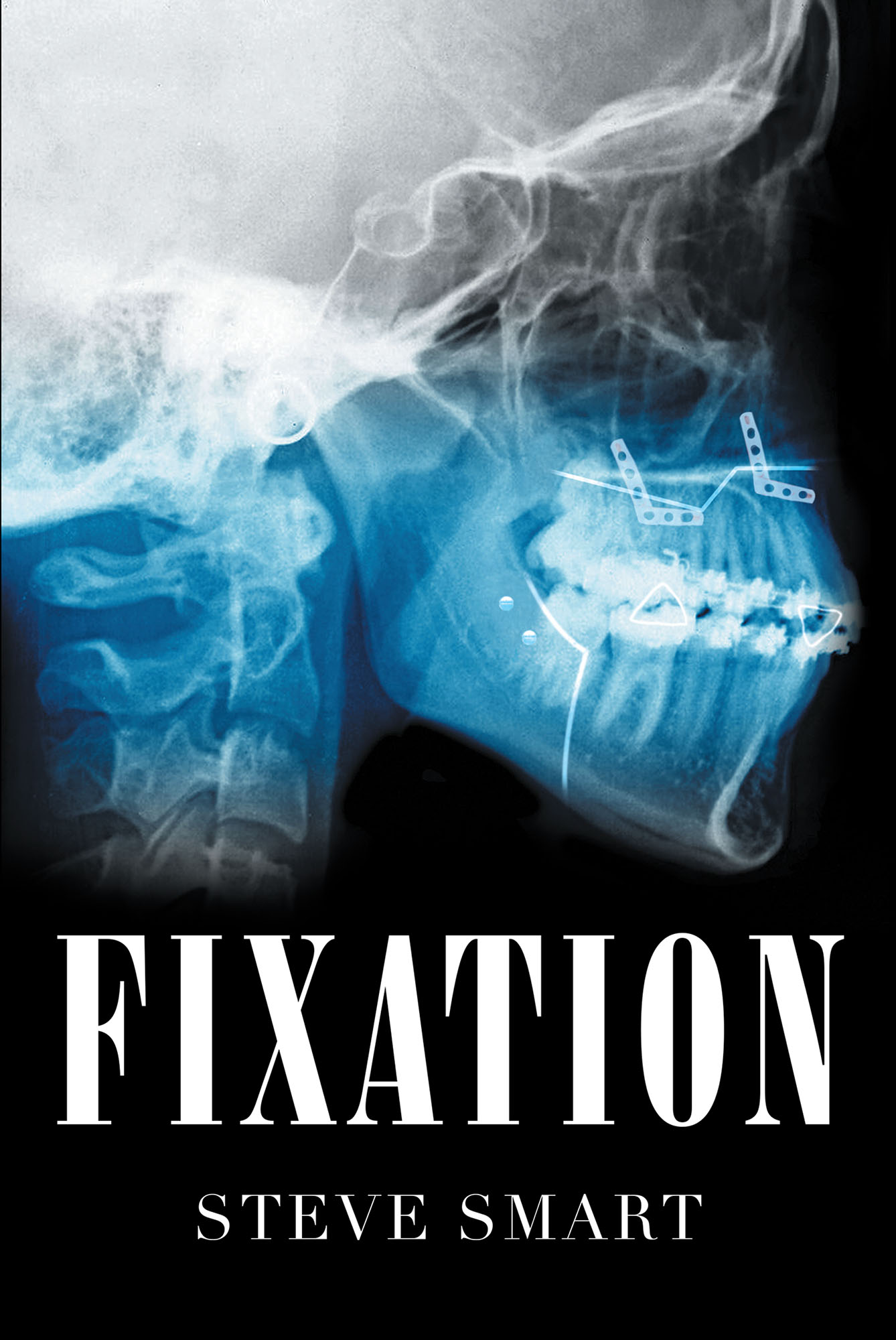 Fixation Cover Image